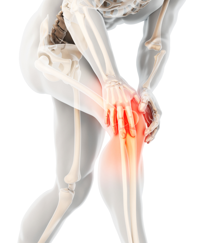 Osteoarthritis And Osteoporosis – Symptoms, Differences And Treatments